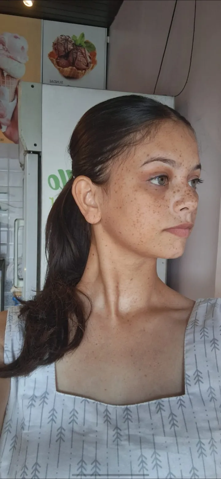 Hello, I’m based in Nagpur and I have natural freckled skin. I’m available as a model for… by Janki Gaware